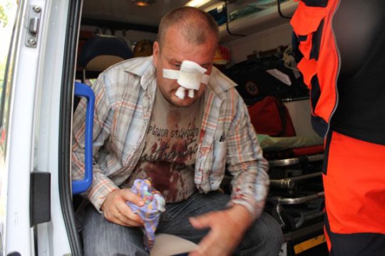 В Варшаве футбольные хулиганы жестоко избили белорусов - фото