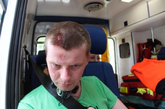 В Варшаве футбольные хулиганы жестоко избили белорусов - фото