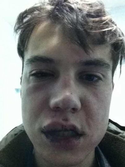 В Мозыре избили Егора Волчка, бывшего участника детского «Евровидения» (фото)