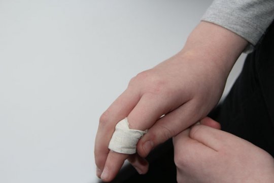 Мужчина пострадал от хлопушки