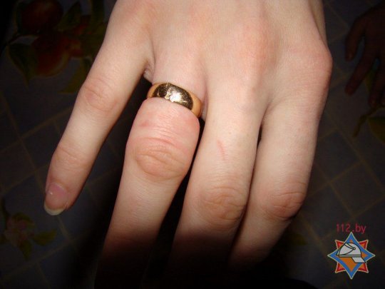 На Гомельщине спасатели дважды помогли женщинам в снятии колец (фото)