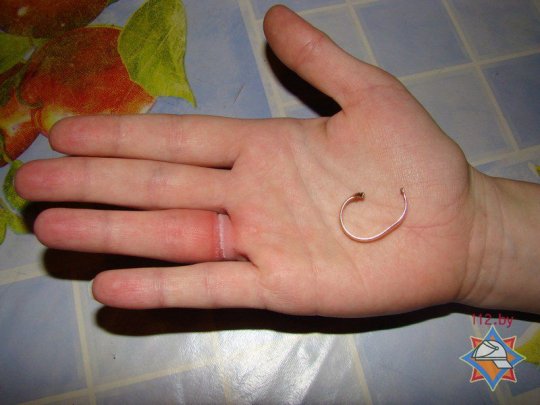 На Гомельщине спасатели дважды помогли женщинам в снятии колец (фото)