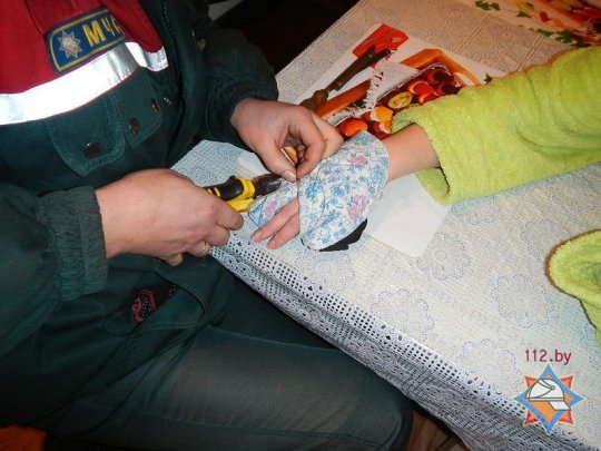 На Гомельщине спасатели дважды помогли женщинам в снятии колец (фото)