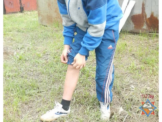 В Речице школьник застрял ногой между гаражами (фото, видео)