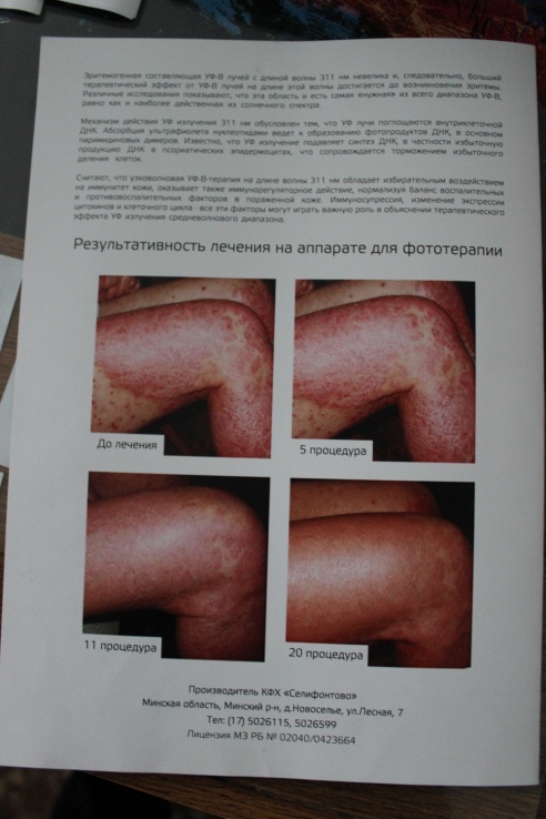 В Гродно появился уникальный аппарат для лечения кожных заболеваний