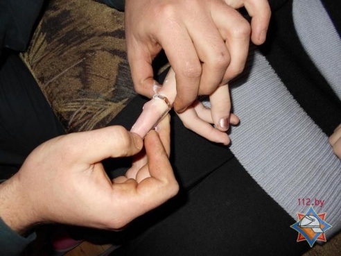 В Калинковичах спасатели помогли школьнице снять кольцо с пальца (фото)