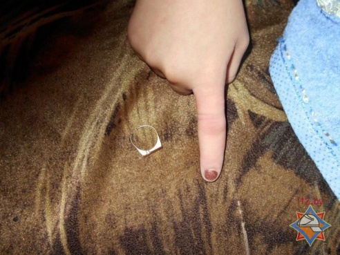 В Калинковичах спасатели помогли школьнице снять кольцо с пальца (фото)