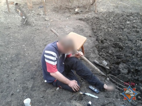 В Калинковичах мужчина проткнул вилами ногу (фото)