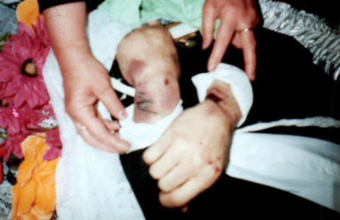 Мать погибшего после пребывания в ИВС Александра Акулича опубликовала снимки тела своего сына