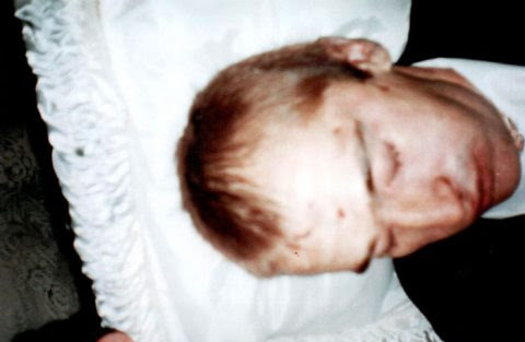 Мать погибшего после пребывания в ИВС Александра Акулича опубликовала снимки тела своего сына