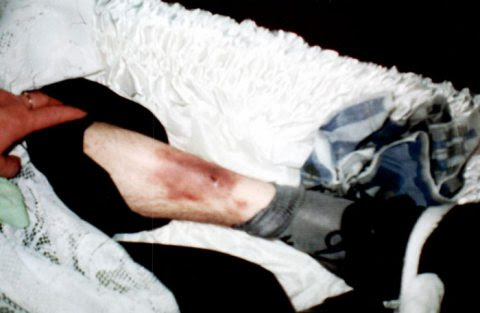 Мать погибшего после пребывания в ИВС Александра Акулича опубликовала снимки тела своего сына