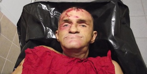 Определяют личность человека, которого насмерть сбил поезд возле Селивоновки (Внимание, фото погибшего)