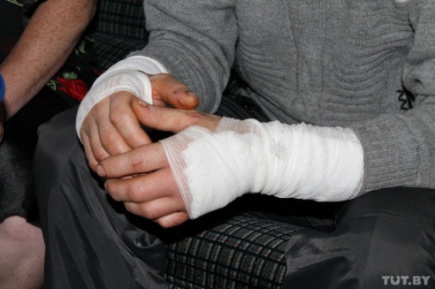 Волк против Медведов: как в Светлогорском районе сельчане отбивались от дикого зверя