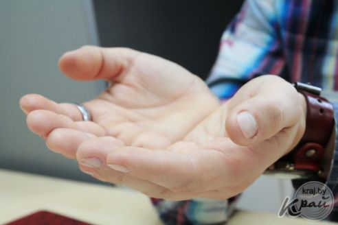 «Я несколько раз умирал». Исповедь бывшего наркомана из Молодечно, который не боится показать лицо (фото)