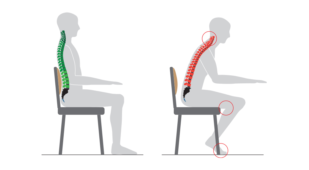 Как влияет на стул. Искривление позвоночника из за компьютера. Неправильное положение спины. Позвоночник сидящего человека. Плохая осанка за компьютером.