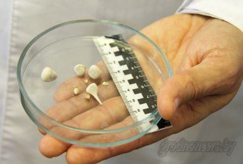 Гродненские эксперты освоили методику установления химического состава почечных камней