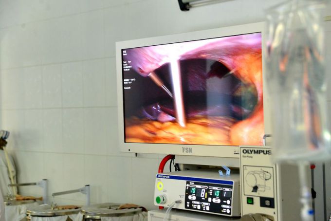 В гомельской больнице появился комплекс для бесшовных операций